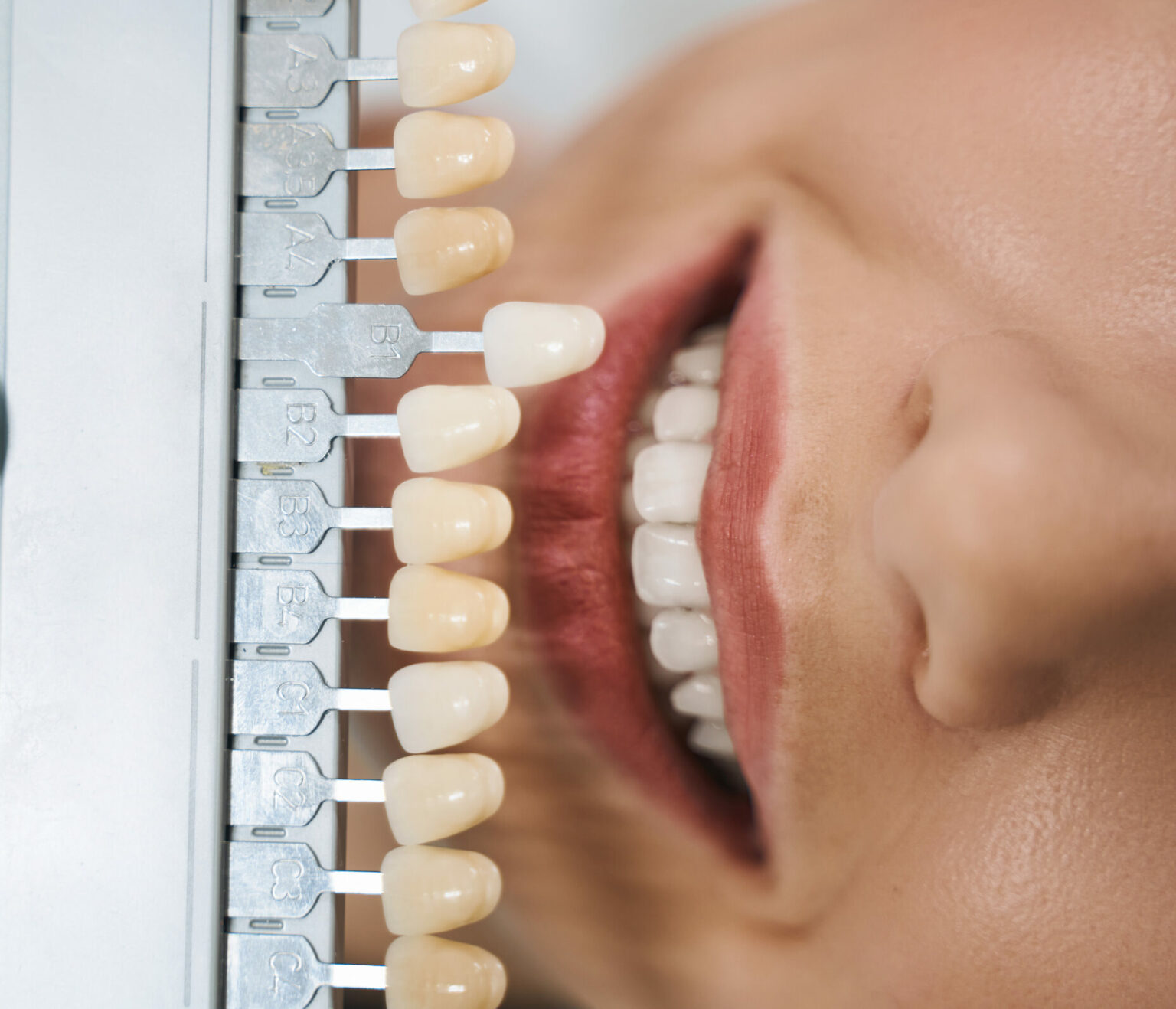 Redeem your CDC voucher here at WeSmile Dental Clinic!