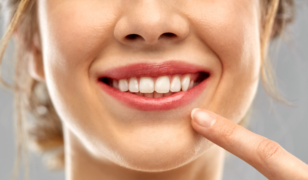 Straight teeth
