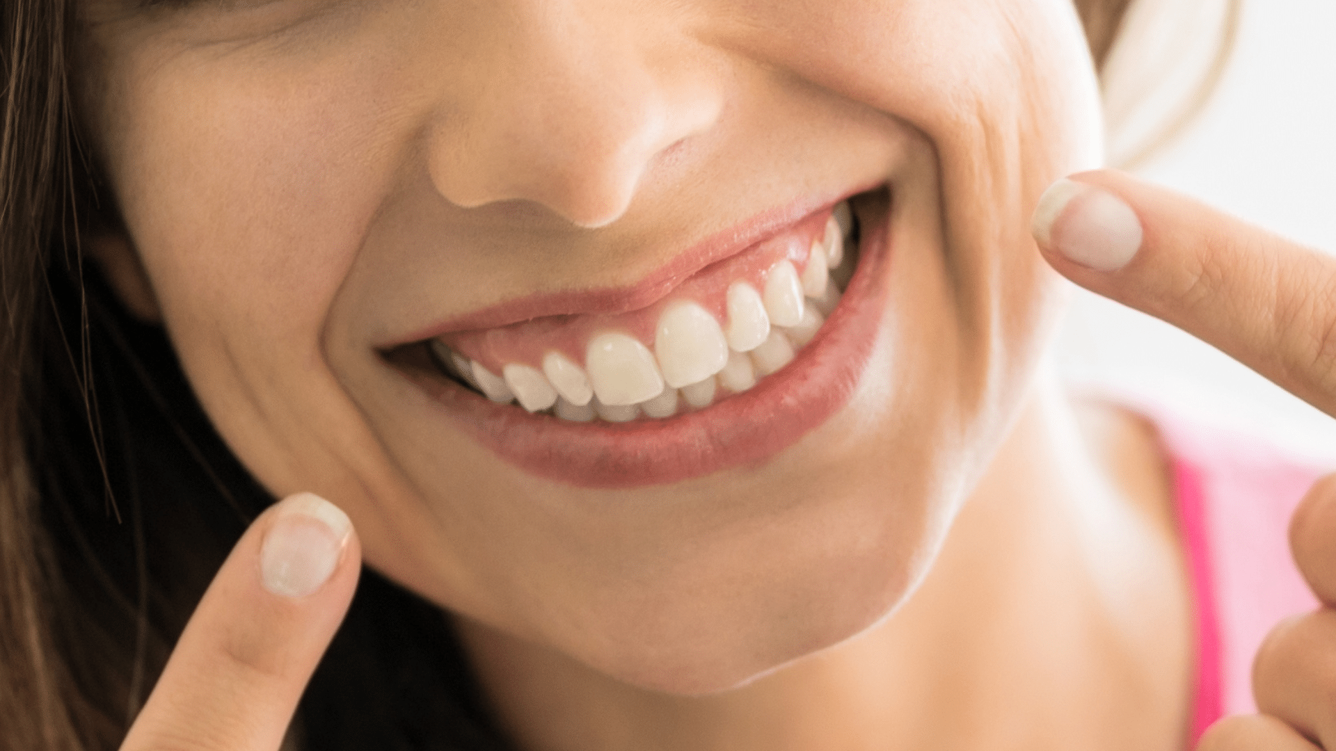 Teeth stain removers guide