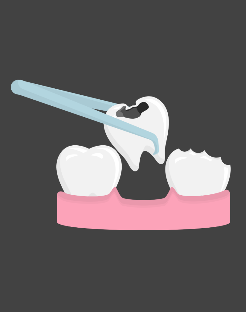 Dental bone grafts A comprehensive guide