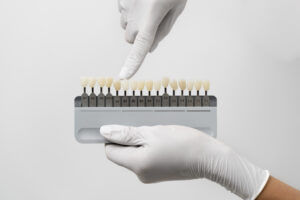 Dentist showing different shades of veneers