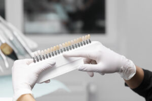Dentist holding veneers' samples