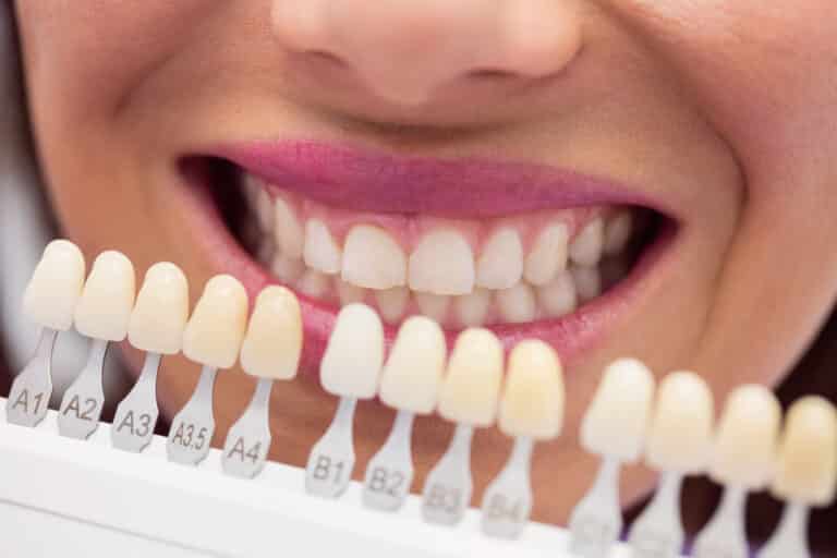 Asian choosing Veneers