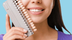 Teeth Veneers