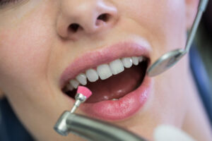 Teeth Whitening Singapore