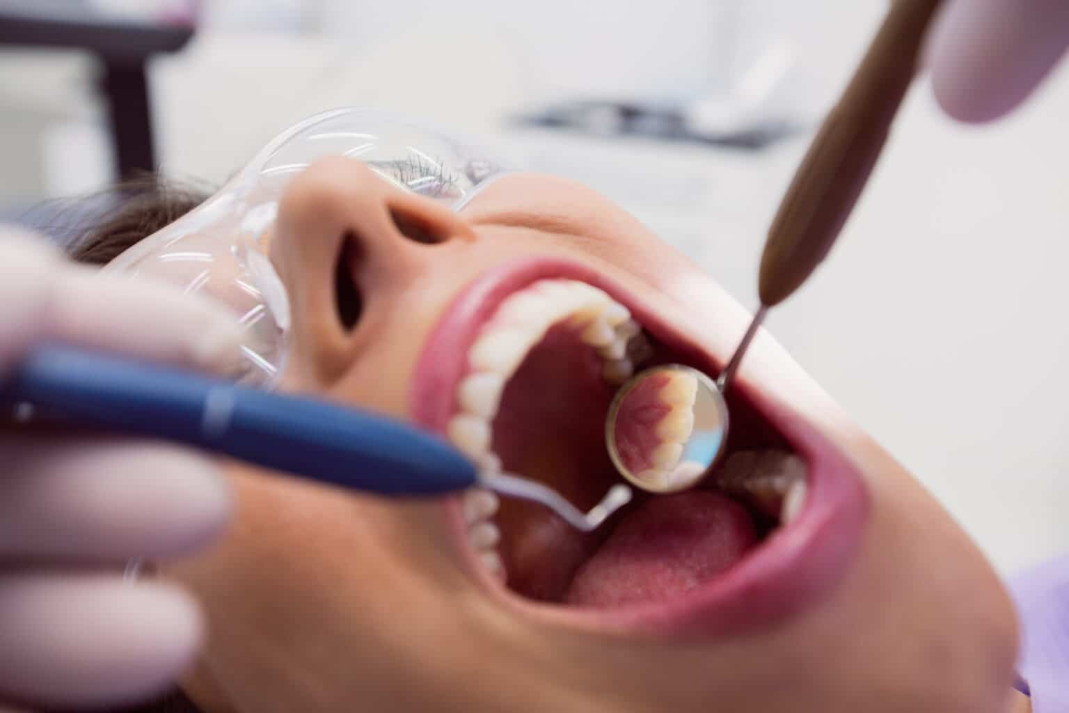 Dentist examining a female patient with tools at dental clinic