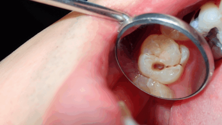 Endodontist Singapore