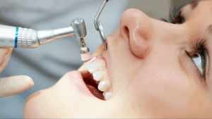 Teeth cleaning price: what every patient should know