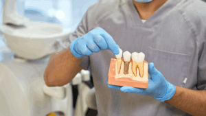 How long do dental implants take to heal? Your complete guide