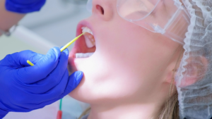 Dentist Near Me for Teeth Scaling and Polishing