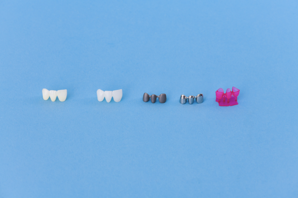 Dental Crowns in Singapore