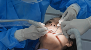 How to treat swollen gums