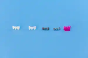 A row of five three-unit dental bridges on a bright blue background. From left to right, the bridges progress through different stages and materials: shaded ceramic, bright white zirconia, dark grey metal framework, polished silver metal, and a vibrant pink 3D-printed resin model.