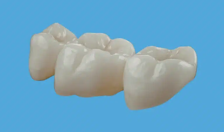 Close-up view of a three-unit dental bridge floating against a blue background.