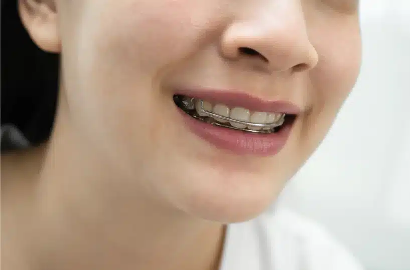Why Early Orthodontic Treatment Matters for Your Child’s Smile