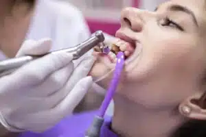 Patient receiving professional dental cleaning to treat gingivitis during pregnancy.