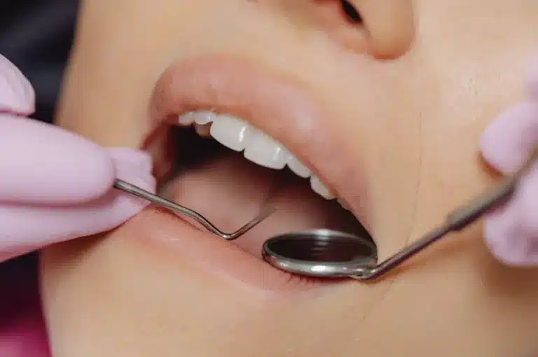 Dentist performing a mouth check during an oral cancer screening in Singapore.