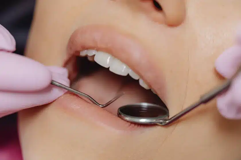 Dentist performing a mouth check during an oral cancer screening in Singapore.