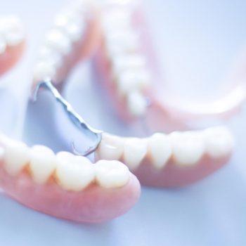 Dealing with tooth loss: Implants or Dentures?