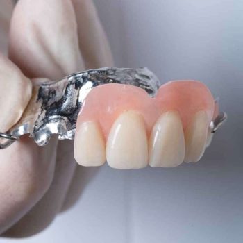 Partial Denture - Front